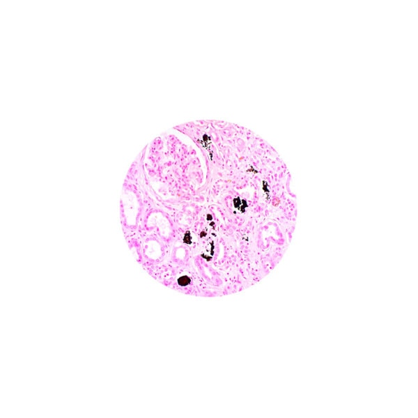 Calcium Stain Kit